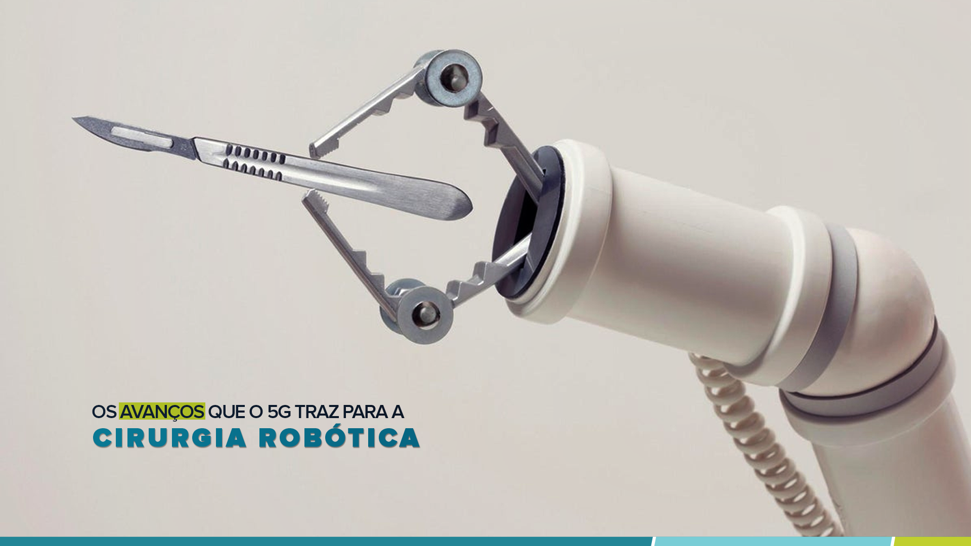 Os avanços que o 5G traz para a cirurgia robótica