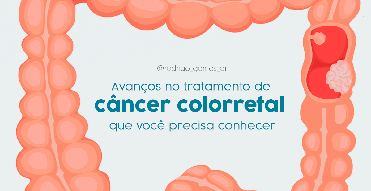 Avanços no tratamento de câncer colorretal que você precisa conhecer